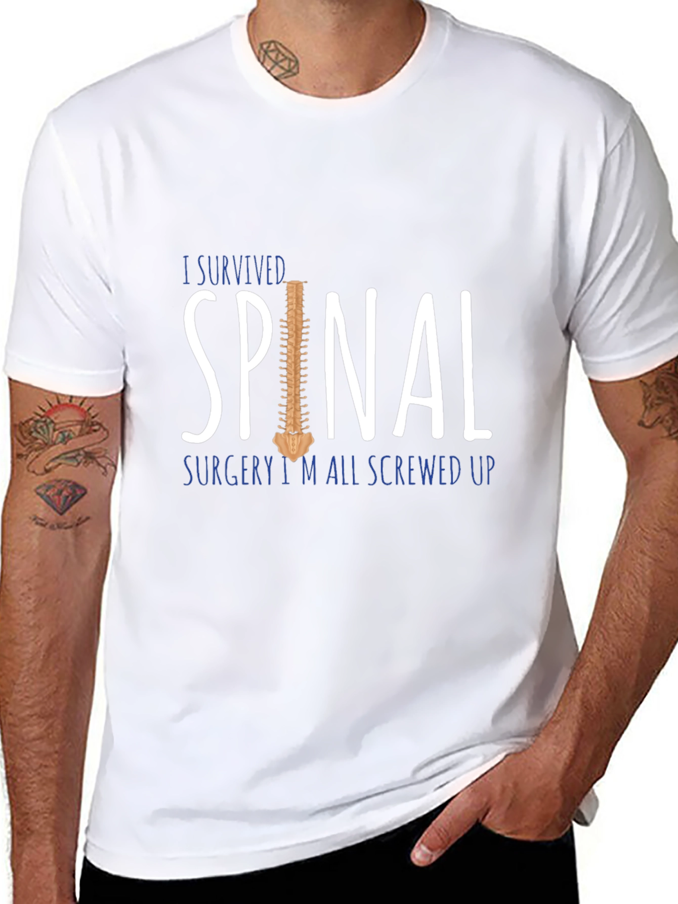 Spinal Surgery Survivor T-Shirt Funny Screwed Up Tee