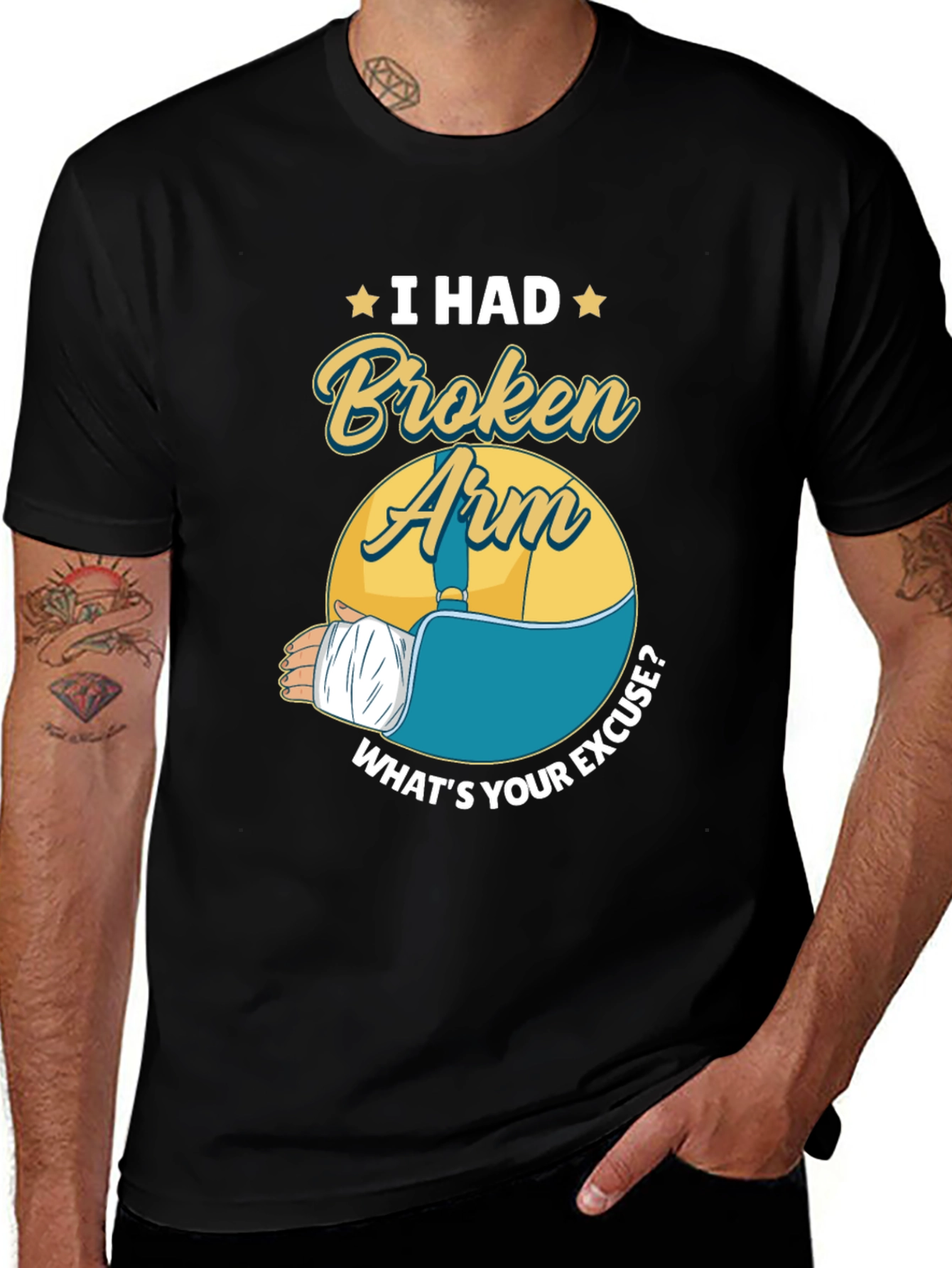 I Had a Broken Arm Graphic Tee